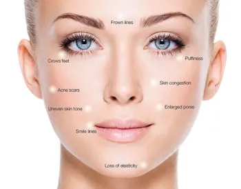 Skin needling