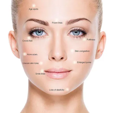 Skin needling